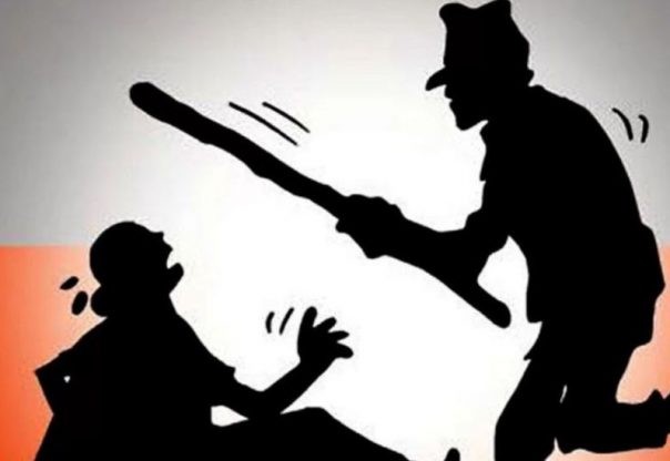 भरतपुर बोटे टोलकी महिलालाई मरणासन्न हुनेगरी कुटपिट गर्ने व्यक्ति पक्राउ