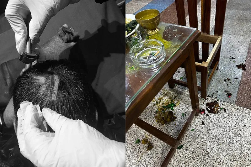 गोरखामा प्रचण्डविरुद्ध उठेका एमाले उम्मेद्वार अब्दुसको टोलीमाथि आक्रमण, एकजना गम्भीर घाइते