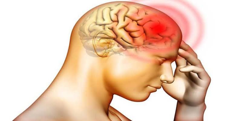 मस्तिष्कघातबाट प्रत्येक वर्ष ५० हजारभन्दा बढी प्रभावित